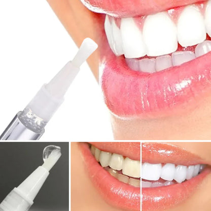 ShinySmile™ — Instantly Whiten & Boost Confidence | 1+1 FREE